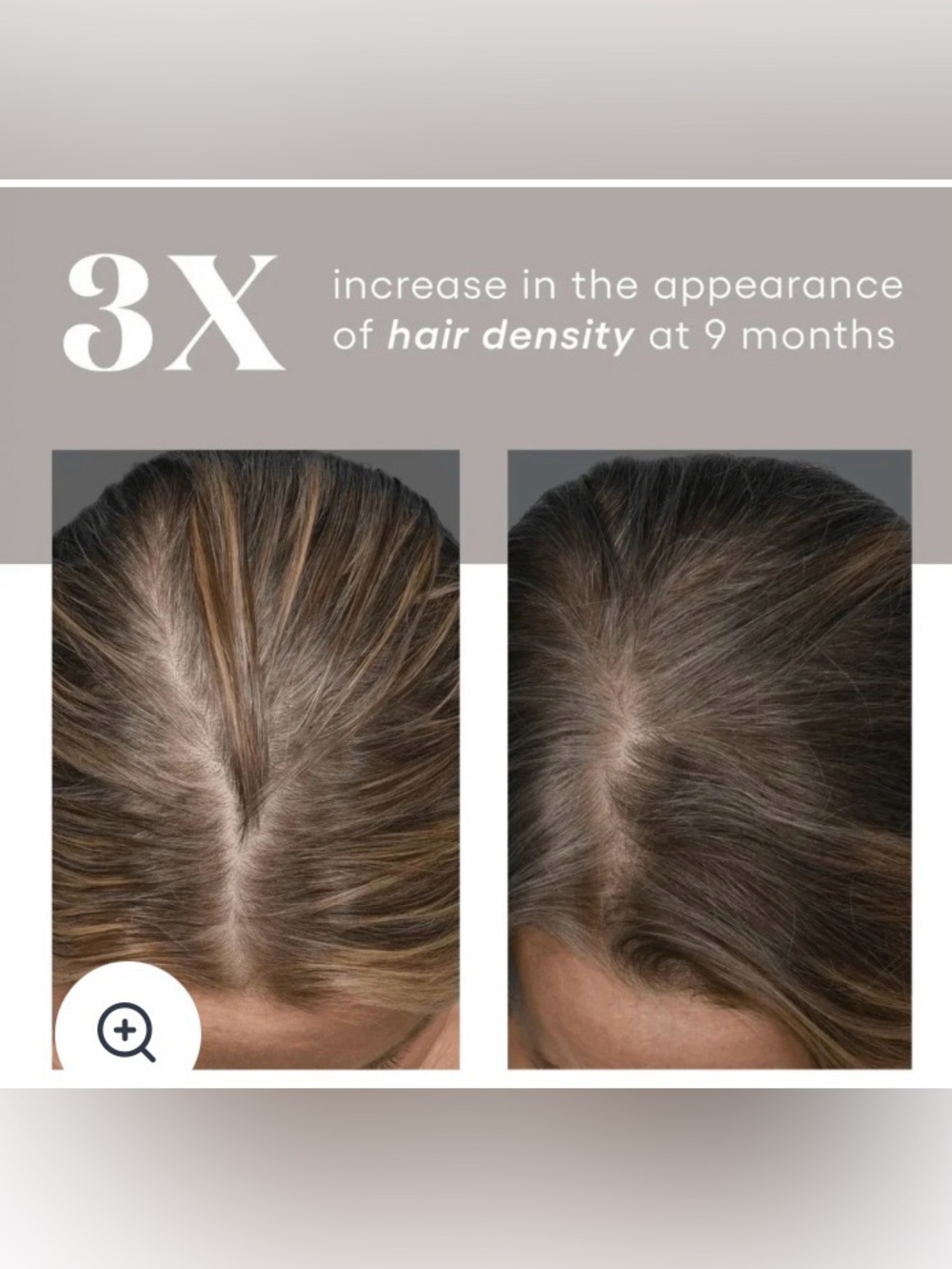 Plated, new in box sealed with exosomes medical grade, unisex hair growth serum - Picture 7 of 12